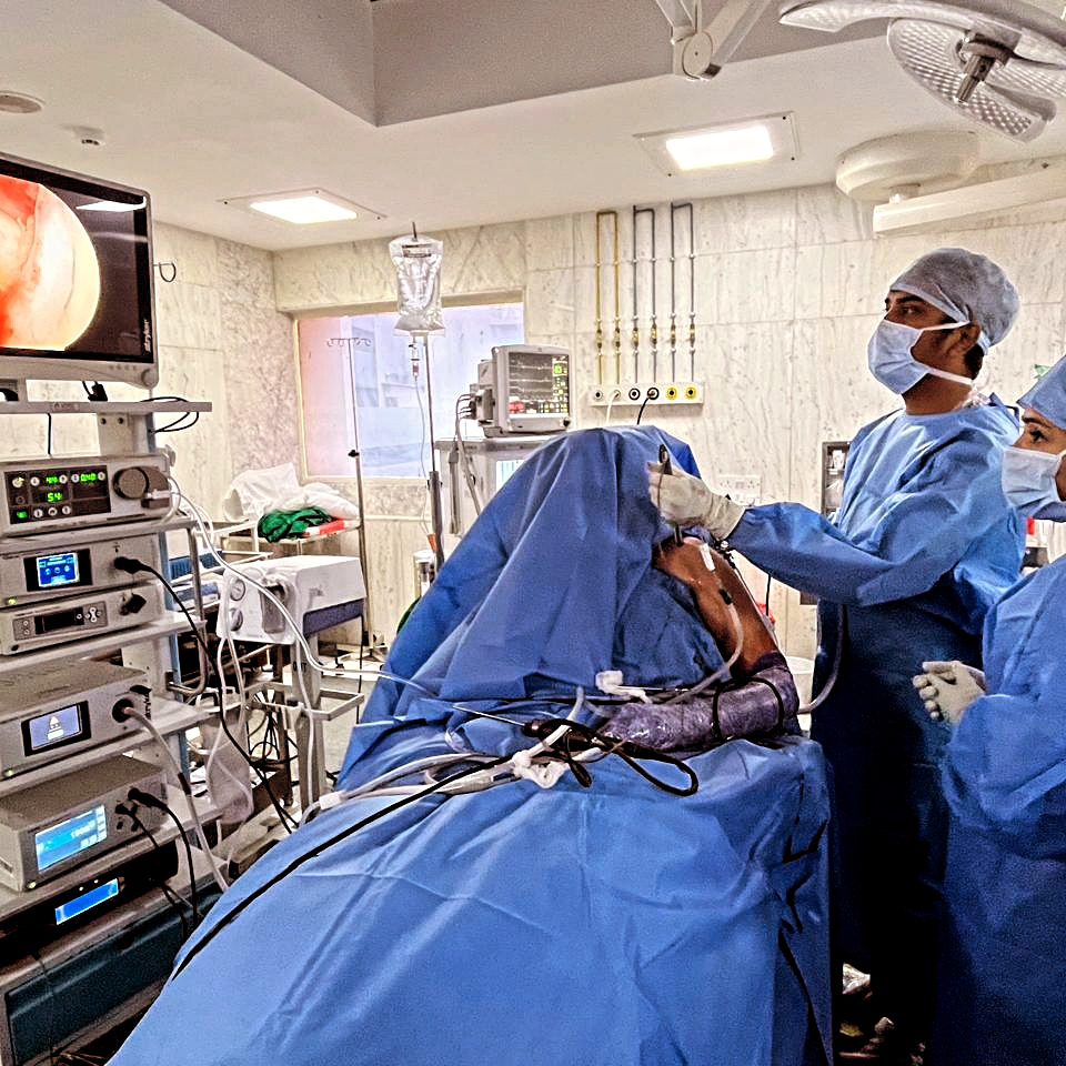 Shoulder arthroscopy surgery setup with endoscopic imaging equipment