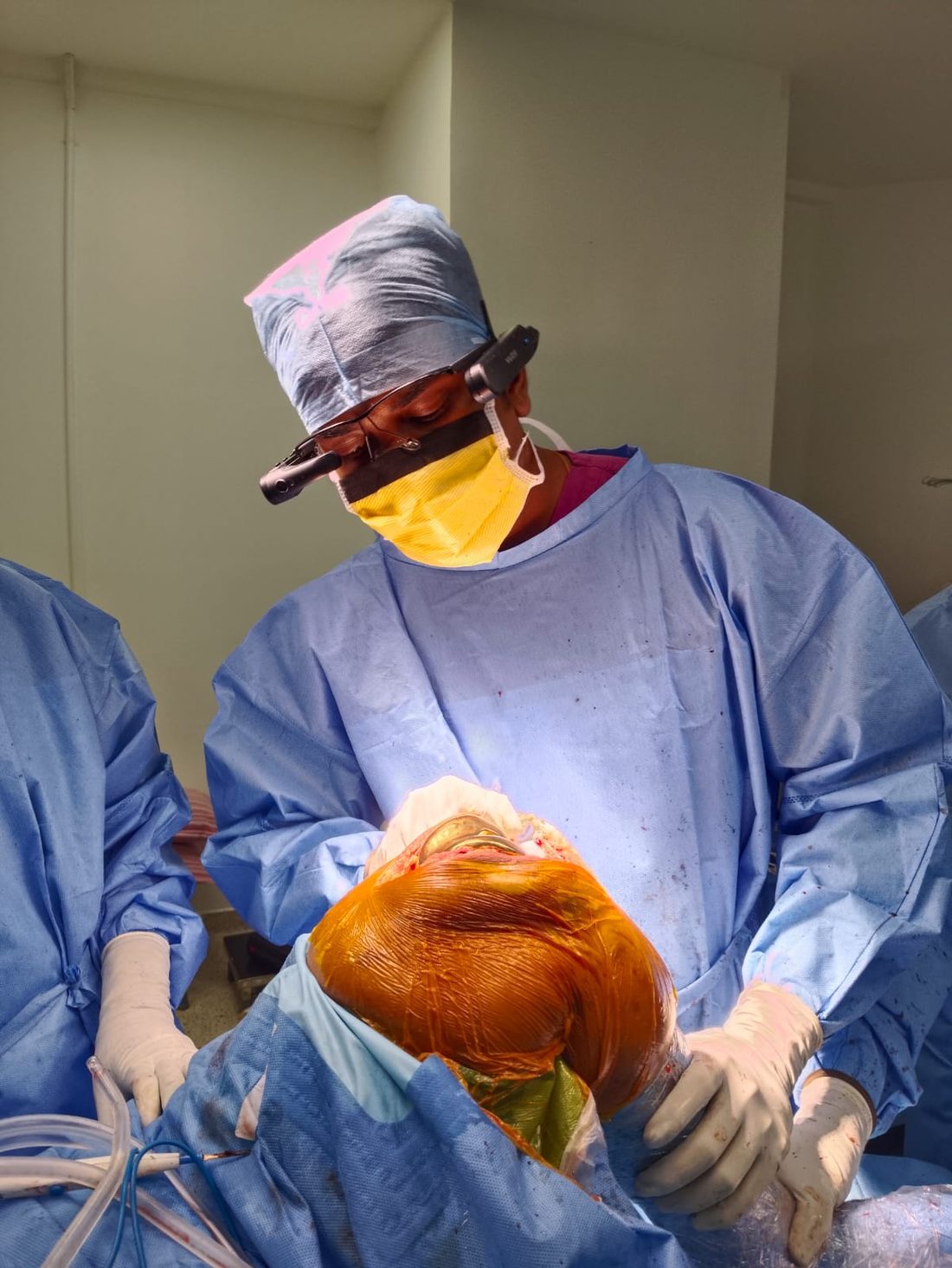 Total knee replacement surgery procedure in the operating theatre